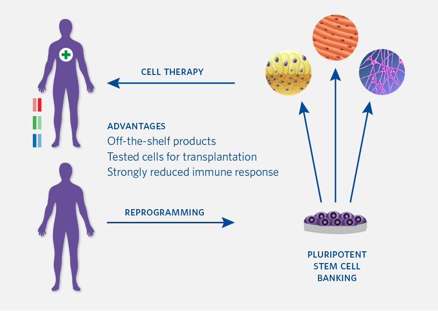 The advantages of iPSC lines from homozygous donors to create off-the-shelf cell therapies