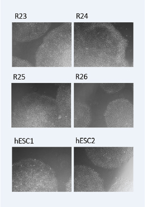 Karyotype and mutation load measured by whole genome sequencing demonstrate that our iPSCs maintain the genetic integrity of their source cord blood cells