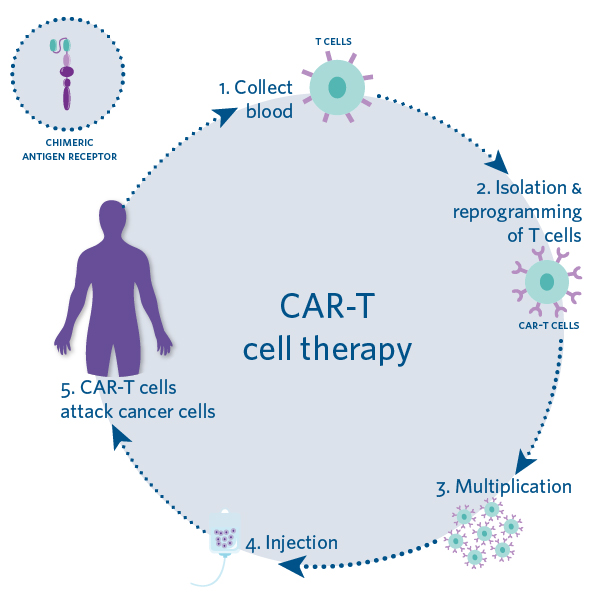 Illustration of the Steps of CAR-T Cell Therapy: 1. Collect Blood 2. Isolation and Programming of T Cells 3. Multiplication 4. Injection 6. CAR-T cells attack cancer cells
