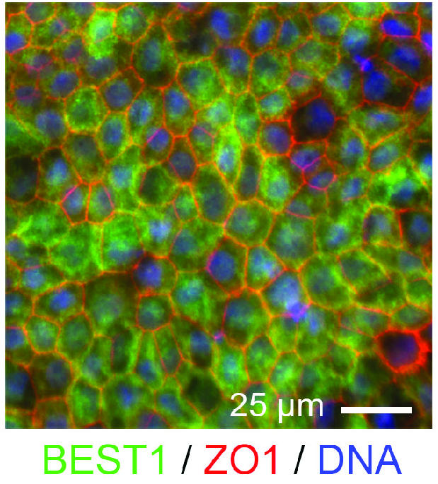 A high magnification, colorized microscopic image showing a cellular monolayer. The cells are outlined by a honeycomb-like network of green, red, and blue fluorescence markers. The green (BEST1) and red (ZO1) markers highlight the cell borders, indicating the presence of specific proteins, while the blue (DNA) stains the cell nuclei. The image has a scale bar indicating 25 micrometers, demonstrating the tight packing and structural organization of the cells. The vibrant colors distinguish between different cellular components, providing a detailed view of the cellular architecture. 